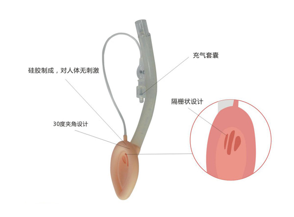 一次性使用喉罩