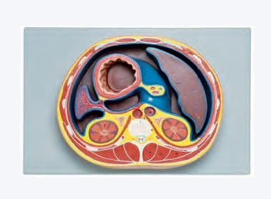 腹腔横断模型HK-BM1097